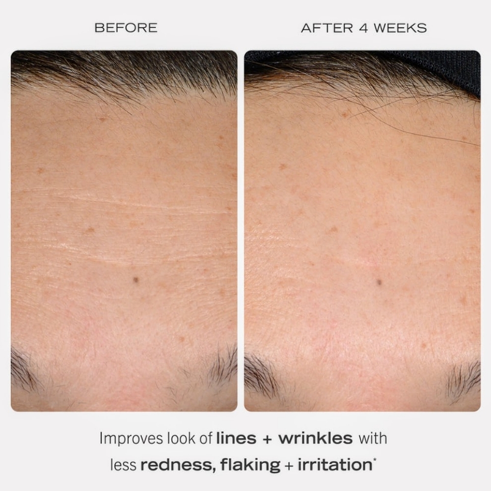 5/$50 First Aid Beauty 0.3% Retinol Complex Serum W/ Peptides Full Size 1 Fl Oz - Picture 3 of 6